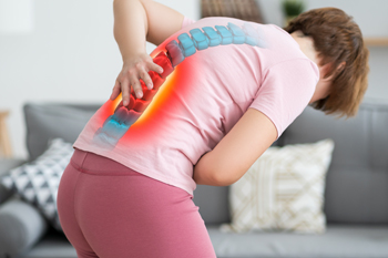 Bulging and Herniated Discs